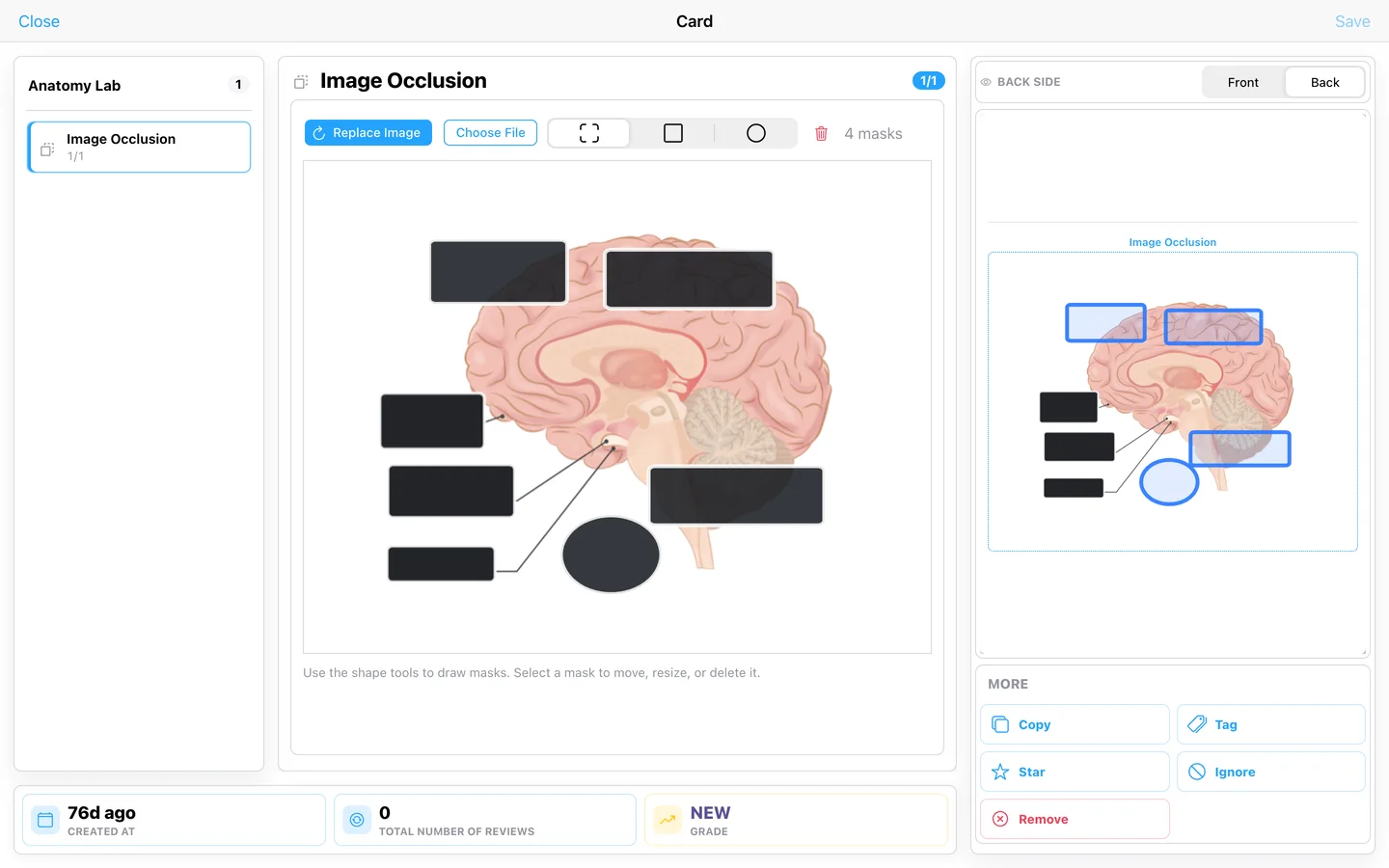 Built-in image occlusion editor masking a brain diagram